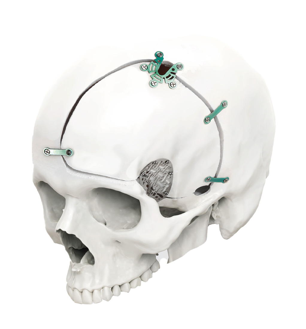 Precision Starts Here