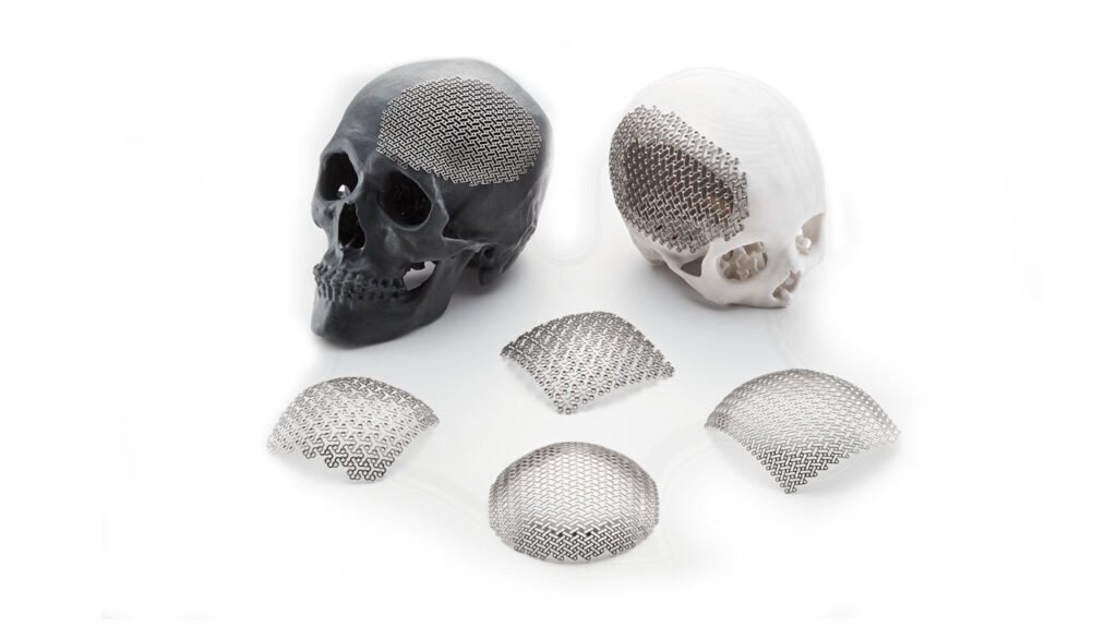 Multiple Large Mesh Options