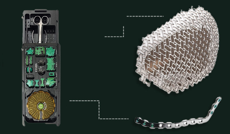  Patient-Specific Implants